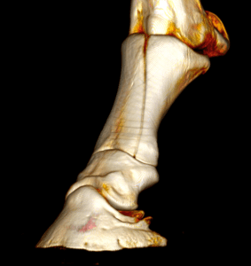 3D CT - volume render showing a fracture of the proximal phalanx