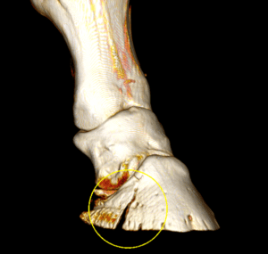 3D CT - volume render showing a fracture of the pedal bone