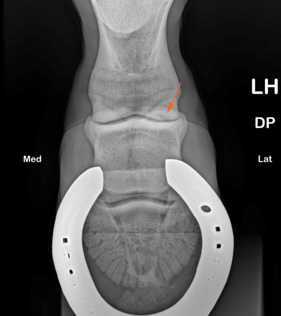 X-ray is useful for seeing fractures, arthritis or bony spurs