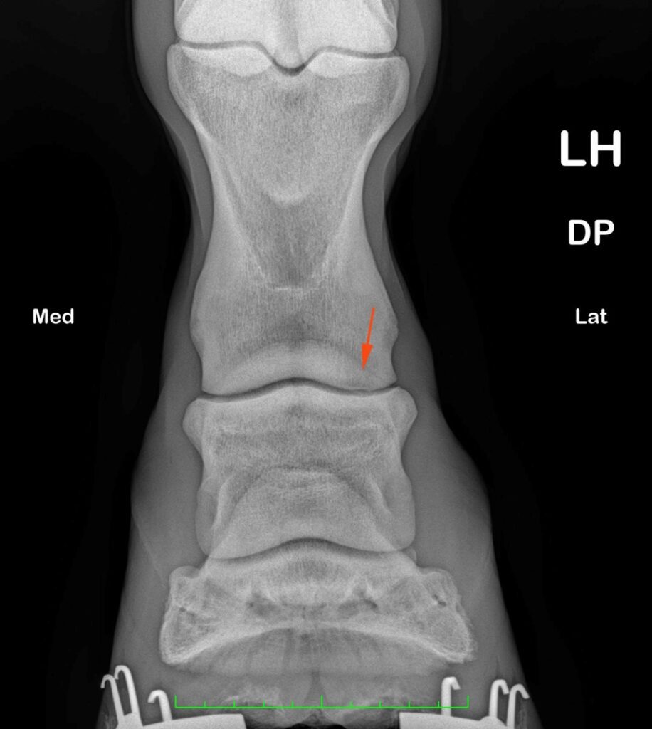X-ray is useful for seeing fractures, arthritis or bony spurs